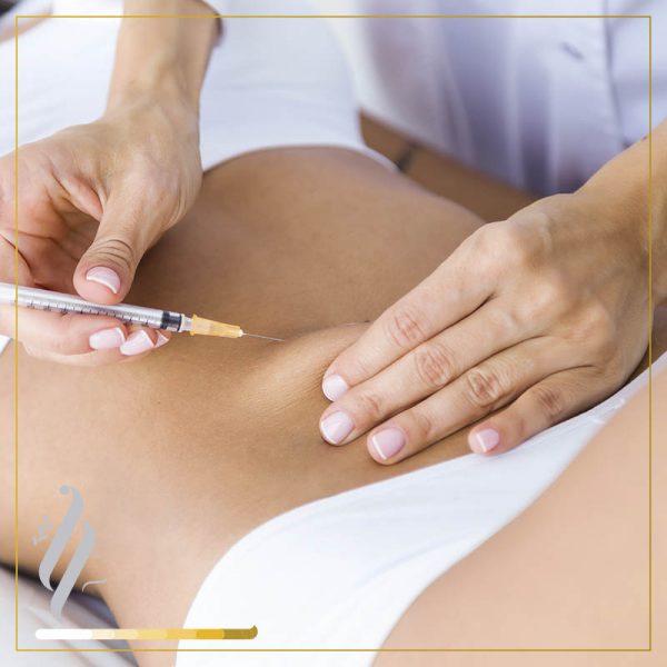 Intralipoterapia