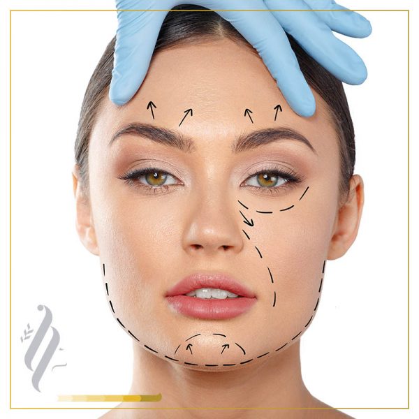 Radiesse ® – Facial