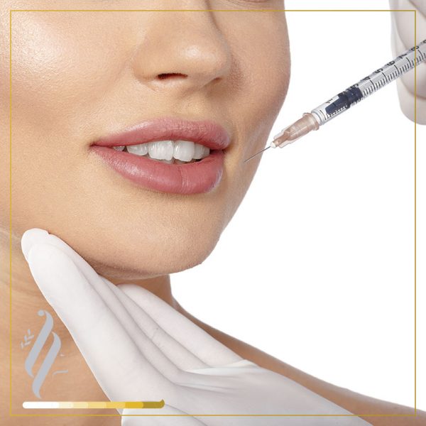 Sculptra ® – Facial